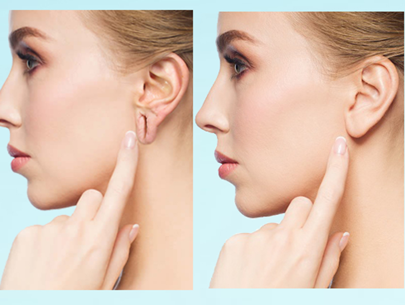 Anti-aging dermatology Chennai